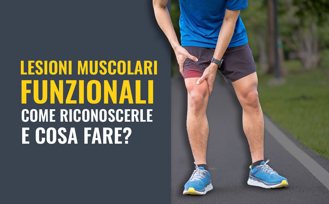 Lesioni muscolari di tipo funzionale: come riconoscerle e cosa fare?