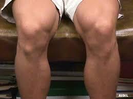 conseguenza mos ginocchio tibia
